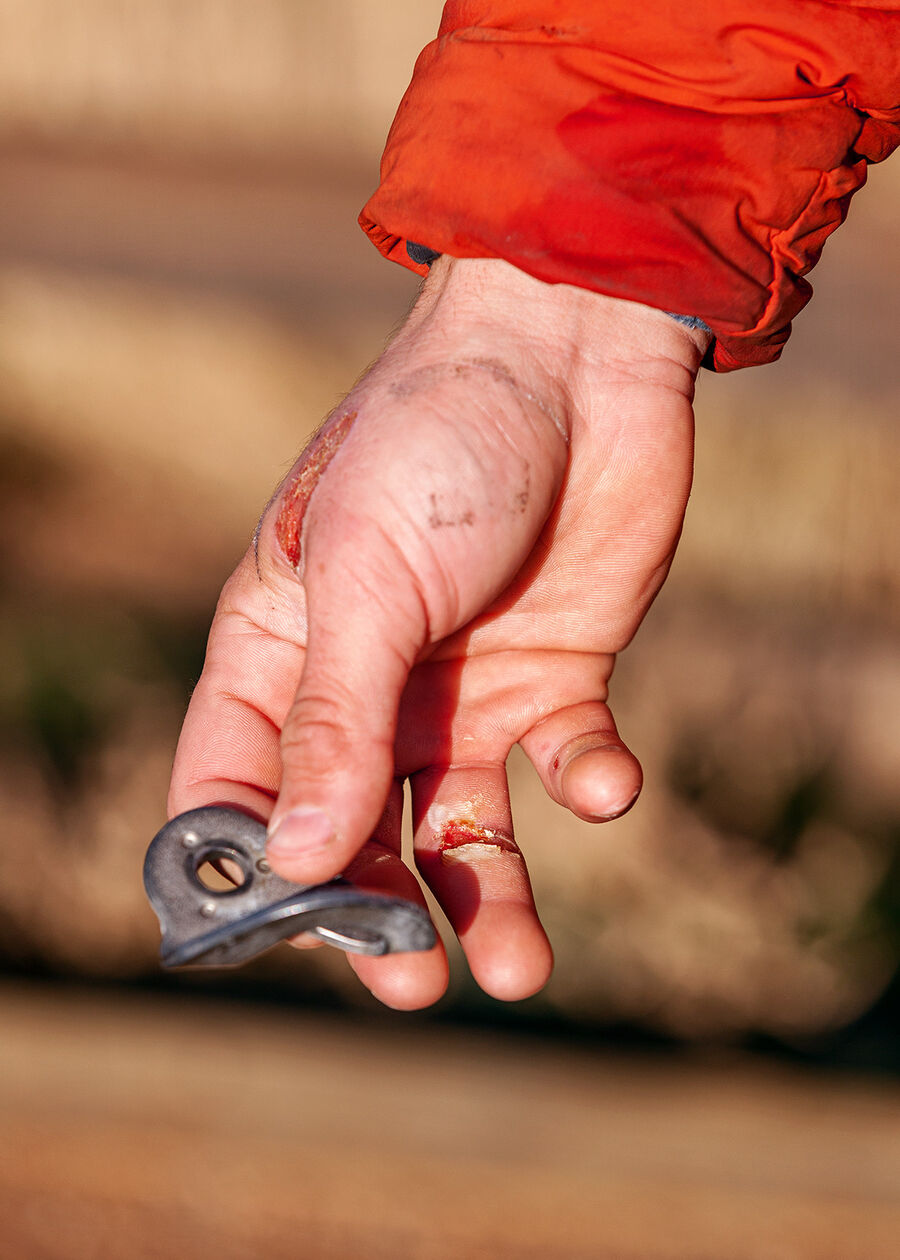 Portrait-oriented color photograph. A tight of a hand and wrist holding a piece of gray metal, shot from a hight angle with the hand, metal, and wrist in focus, but a background that is very soft and out of focus that appears as shapes swirling light and dark brown. The right hand has light skin and is coming from the sleeve of a bright orange jacket whose surface appears fairly dirty. The hand has deep rope burn wounds on the outside of the thumb and inside of the ring finger, with bits of adhesive stuck to the skin from torn-off bandages.