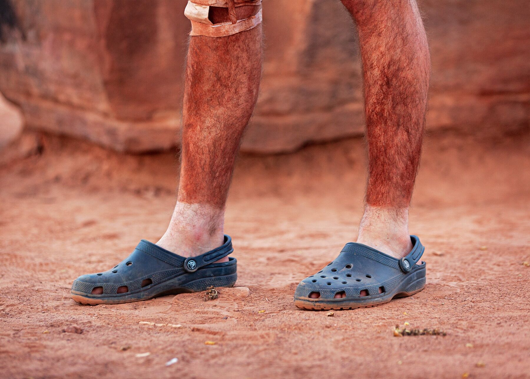 A landscape-oriented color photograph showing a pair of legs, cropped just below the knee, standing in the red earth of the desert, in front of a large sandstone boulder. The person's legs are covered in a thick layer of red sand that ends abruptly at a hard line at his ankles where his socks, which he is no longer wearing, were, but are now exposed because he is wearing a pair of low-cut dark blue crocs. His right leg is bandaged up near the knee.