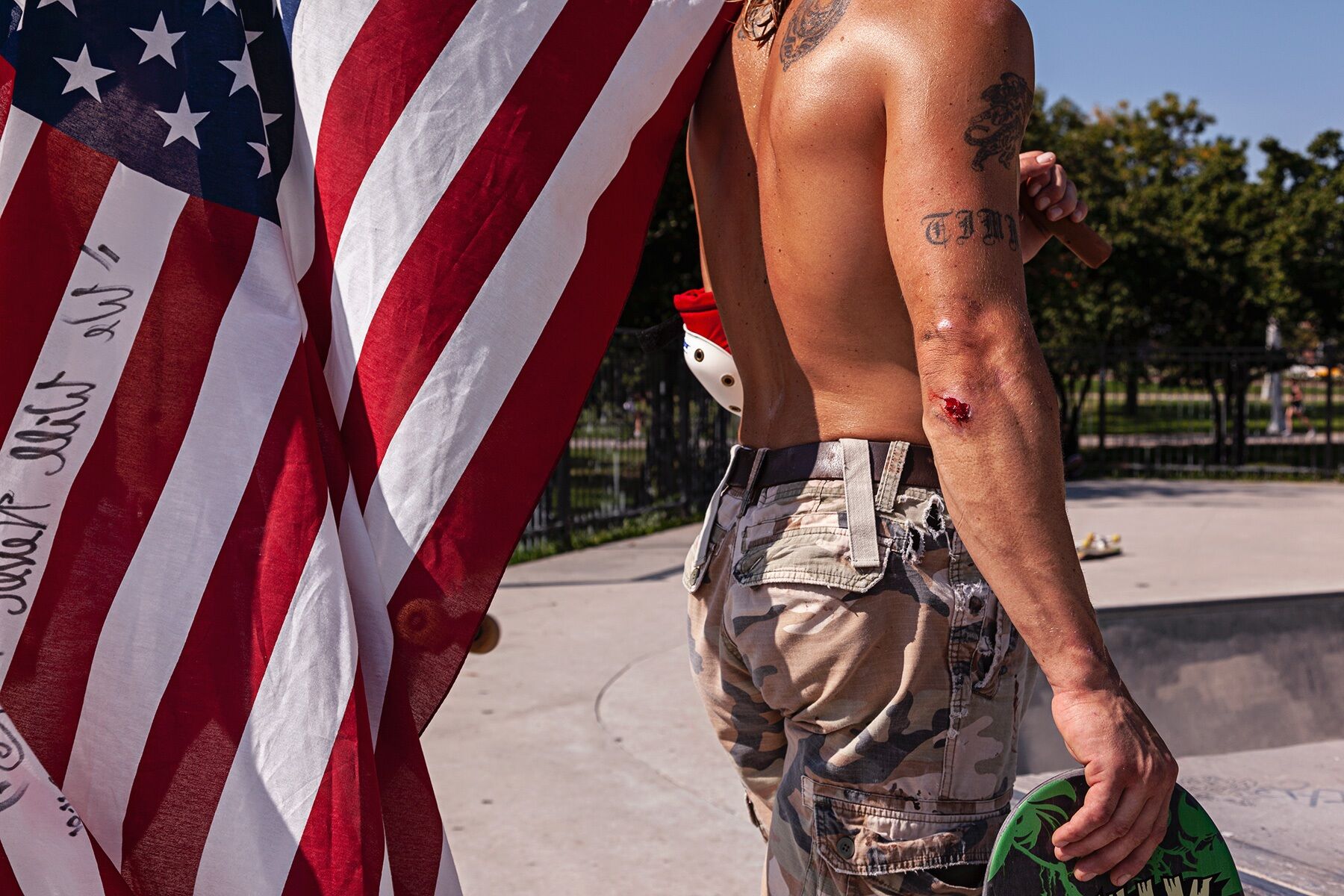 Tim holding an American flag over his shoulder with a bloody elbow